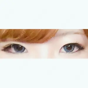 before image