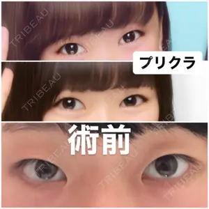 before image