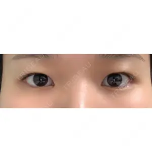 before image