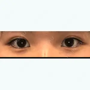 before image