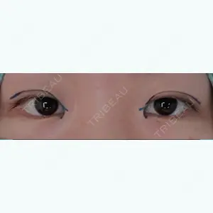 before image
