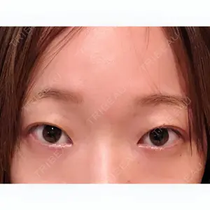 before image