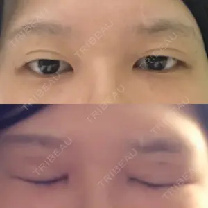 before image