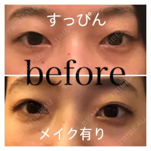 before image