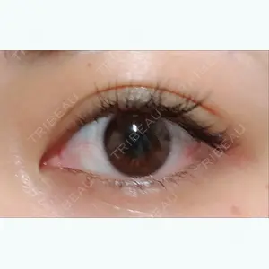 before image