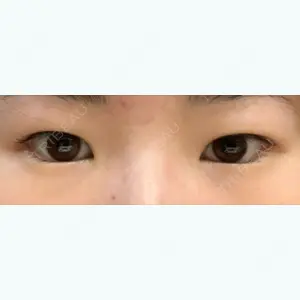 before image