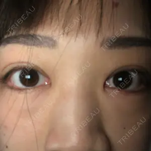 before image