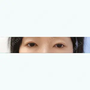 before image