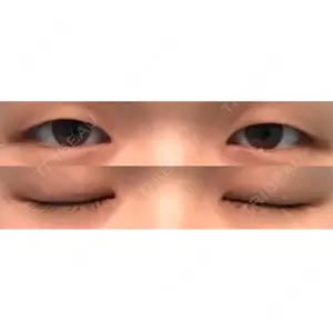before image