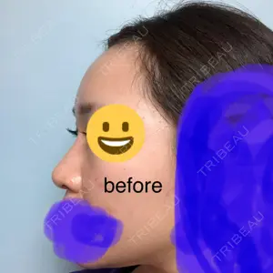 before image