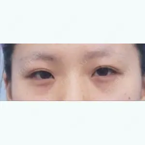 before image
