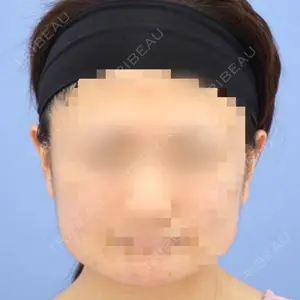 before image