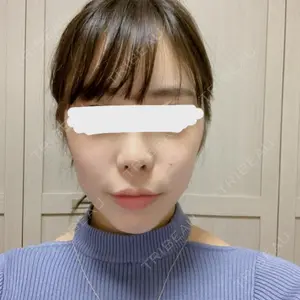 メイドヤング美容整形外科のソボムシン医師口コミ