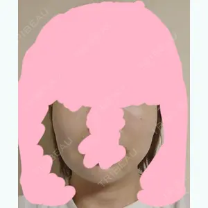 before image