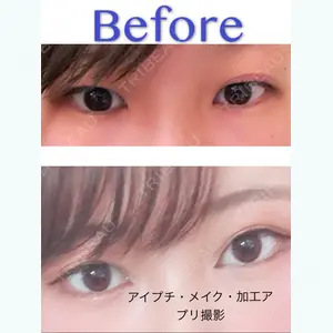 口コミ