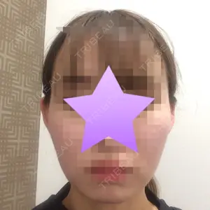 口コミ