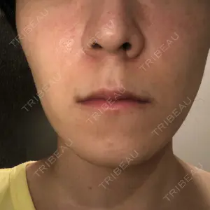 before image