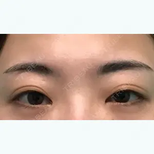 before image