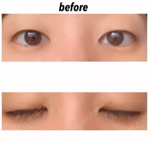 before image