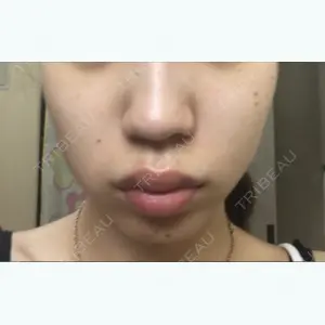4ever（フォーエバー）美容外科・皮膚科の口コミ