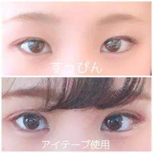 before image
