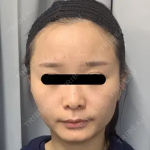 before image