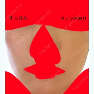 口コミ