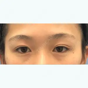 before image