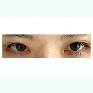 before image
