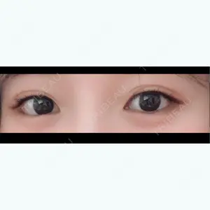 before image