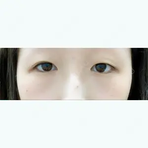 before image