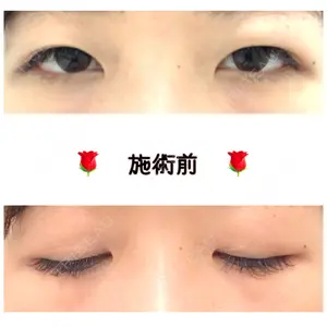 before image