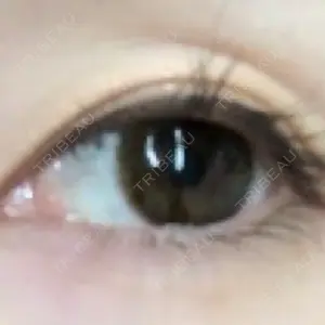 before image