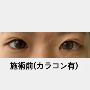 before image
