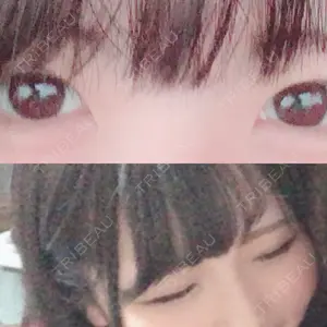 before image