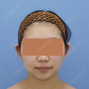 before image