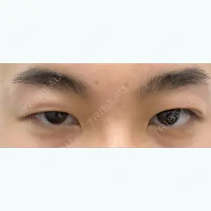 before image