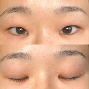 before image