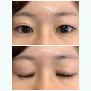 before image