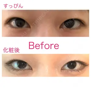 before image