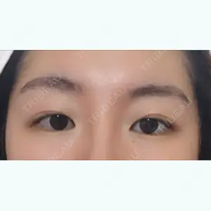 before image