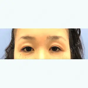 before image