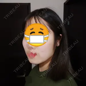 ソウルクイーン整形外科（旧コエンミ整形外科）口コミ