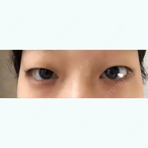 before image