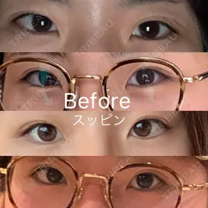 before image