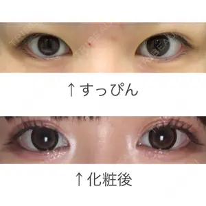before image