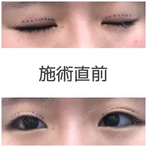before image
