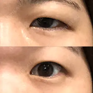 before image