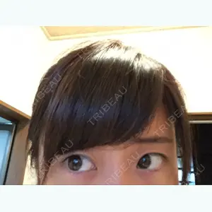 before image