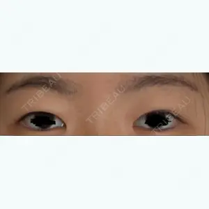 before image